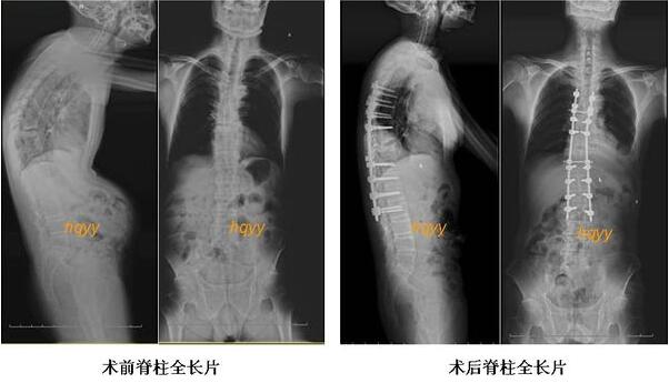 QQ��ͼ20170402150251.jpg