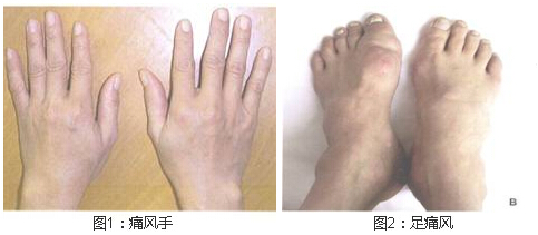 ֣��ʹ���ʪ��ҽԺ����ʹ��.jpg